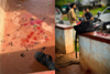 Bantwal: PUC student allegedly stabbed while waiting for bus; love angle suspected